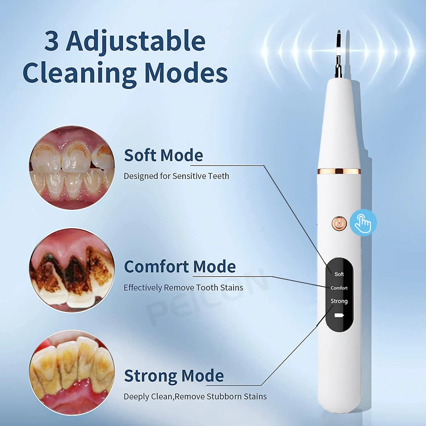 Ultrasonic Dental Stain, Tartar, & Calculus Remover For Teeth